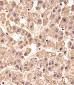 CLN3 Antibody (Center)